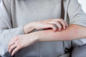 Dermatology photo from Adobe Stock